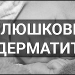 Пелюшковий дерматит – що це таке, визначення, суть, причини та симптоми, методи лікування й профілактики.
